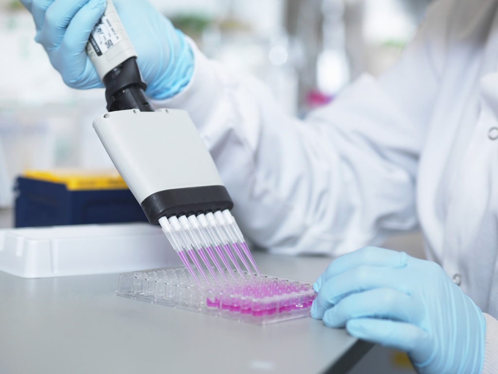 ExoELISA-ULTRA Complete Kit (CD9 detection)   